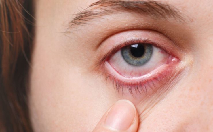 Modern Imaging in Early Detection of Eye Diseases