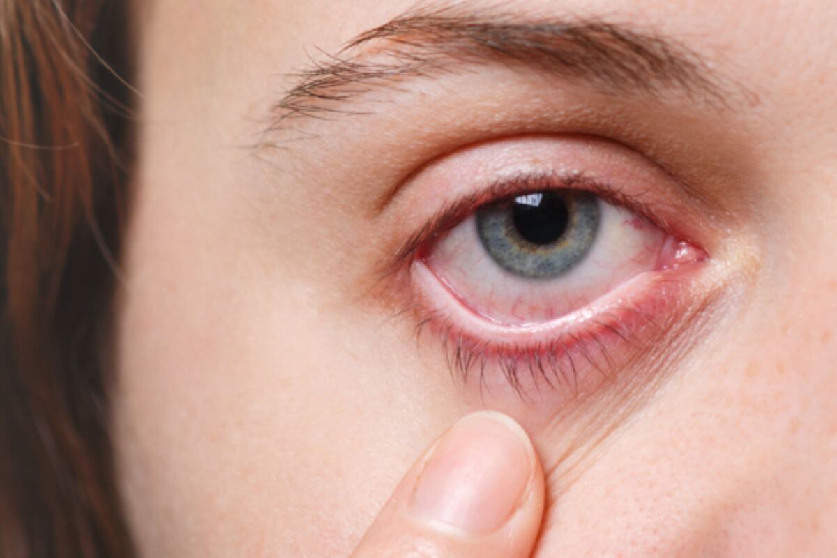 Modern Imaging in Early Detection of Eye Diseases