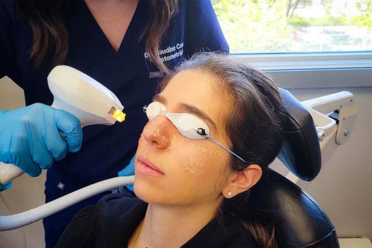 IPL Dry Eye Treatment Session