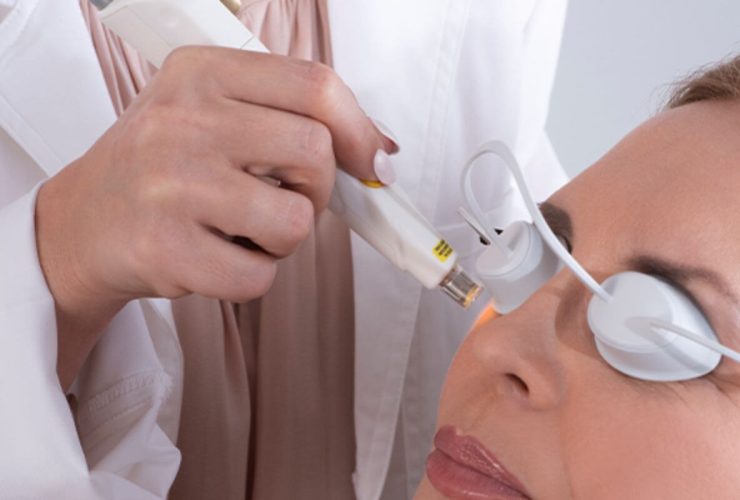 Dry Eyes Are More Than Just an Irritation How OptiLight IPL Can Help