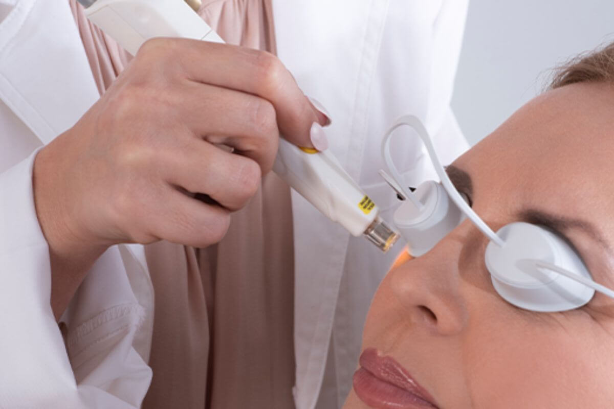 Dry Eyes Are More Than Just an Irritation How OptiLight IPL Can Help